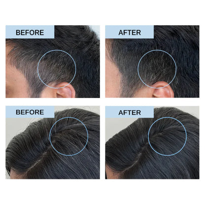 Revival Serum｜Anti-Gray Hair Treatment