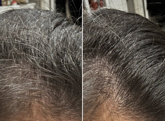 Genesis Formula ｜ Anti-Gray System
